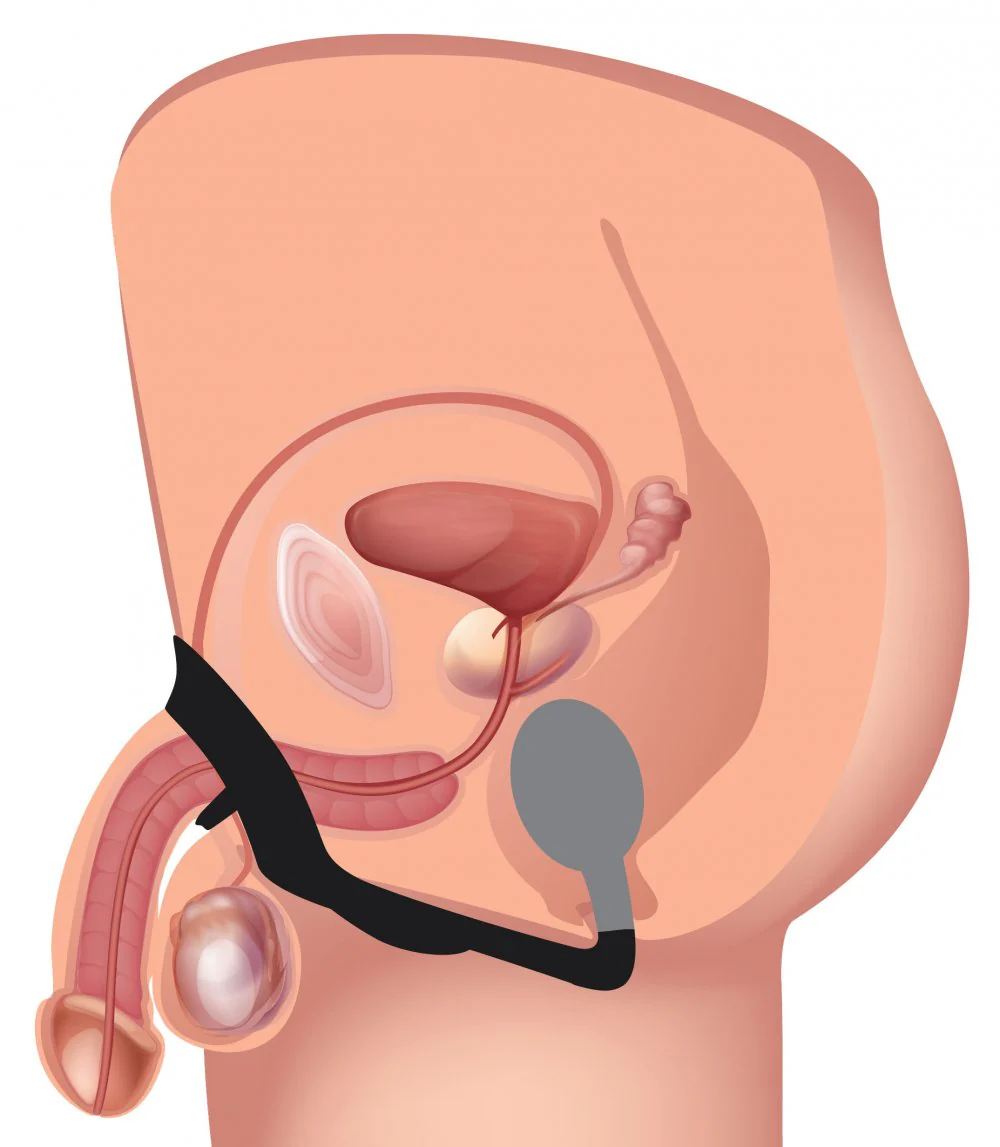 10X P-Bomb Silicone Cock and Ball Ring with Vibrating Anal Plug - Image 5