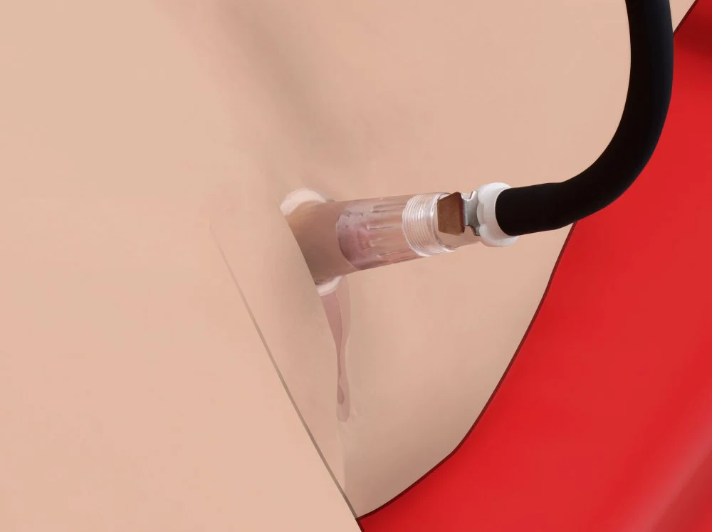 Clitoris Pumping System - Image 4