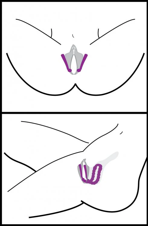Oral Assisting Labia Spreader - Image 4