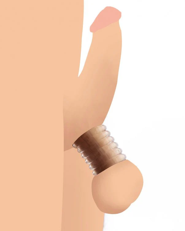 Ring Master Custom Ball Stretcher Kit - Image 2